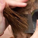 Cara Menghilangkan Kutu di Rambut